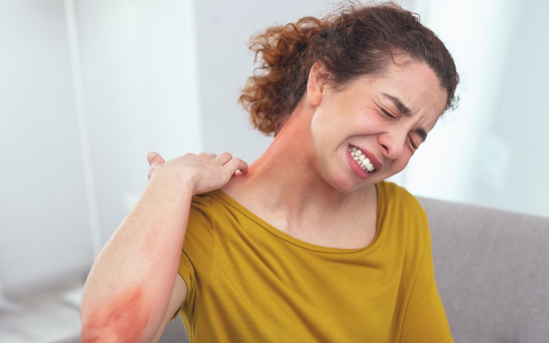 Eczéma lié au stress et kinésiologie